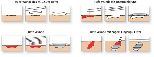 Effektiver Verbandstoff für Wundreinigung Wundbehandlung Prävention